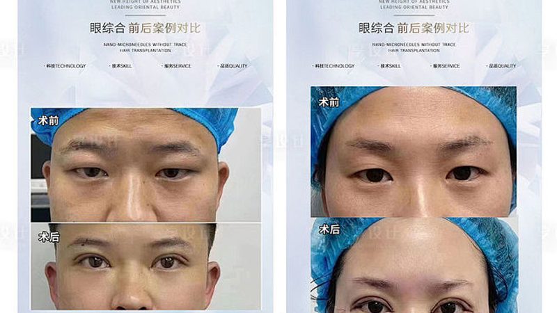 热玛吉广州价格表2025：揭秘价格背后的秘密