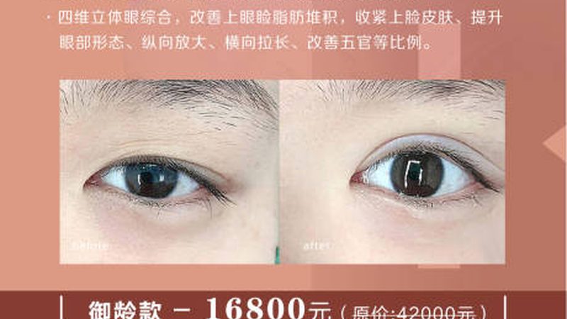 国产隆鼻材料与进口材料：揭秘两者间的差异