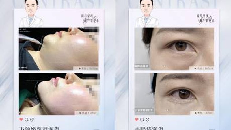 水光针成分和规格怎么选