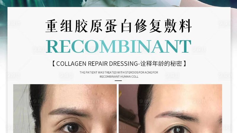 超声炮参数调整，揭秘医美设备操作精髓