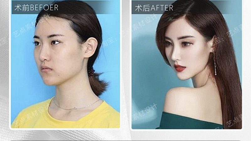 北京激光美容医院的收费标准受到多种因素的影响，以下是一些关键因素：