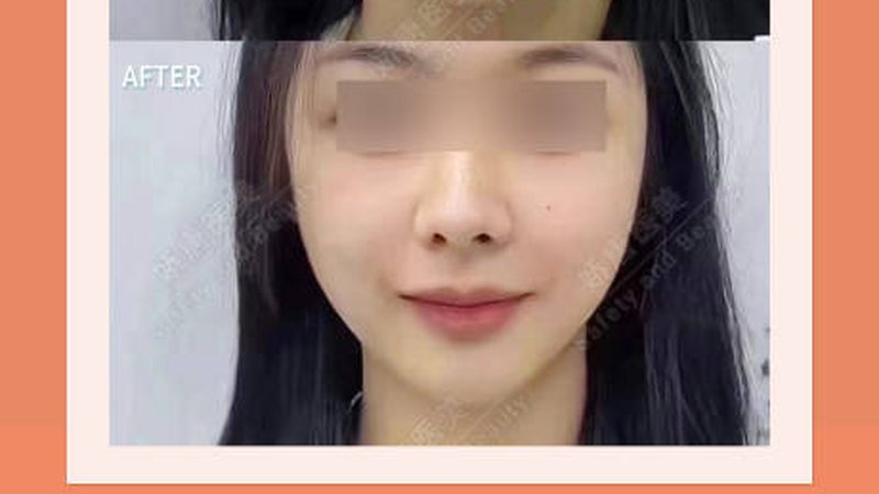 为了避免超声炮治疗间隔时间不当，以下是一些建议：