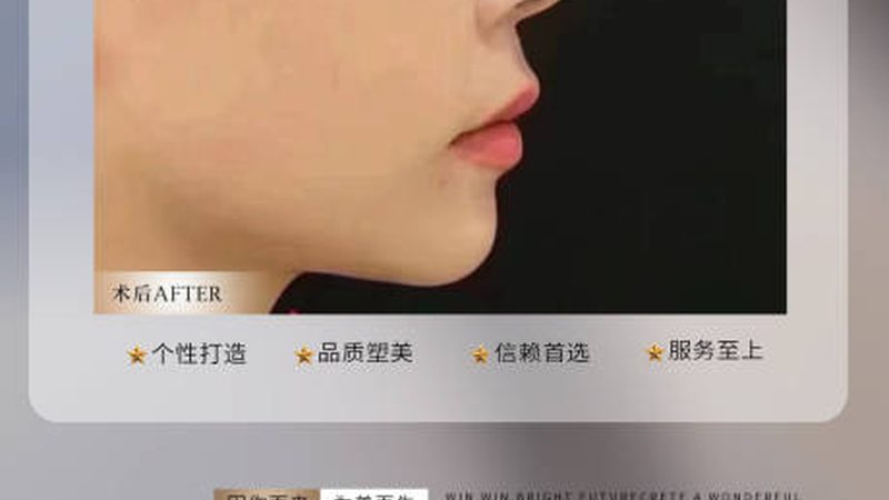 医美咨询师案例库，藏着机构最值钱的资产