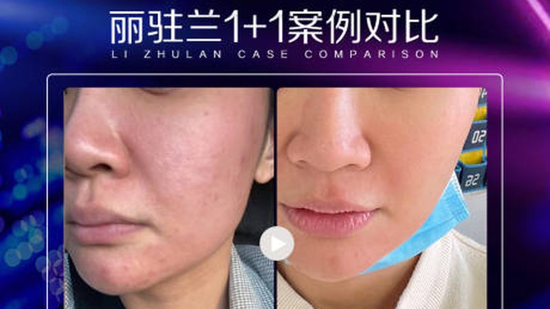 成都轻医美OEM定制：揭秘轻医美产品背后的秘密