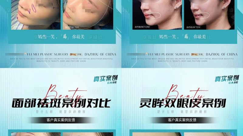 超声炮美容院设备：揭秘性价比之选