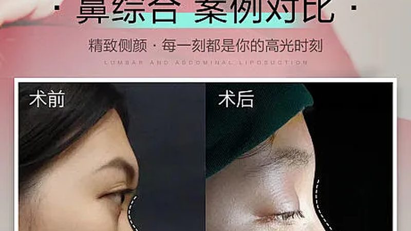 医美医生从业经验：揭秘背后的秘密