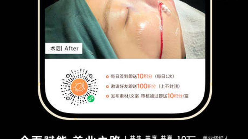 激光美容仪器，揭秘其参数与规格背后的秘密