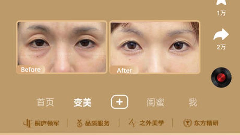 小标题：面部轮廓整形，了解其重要性